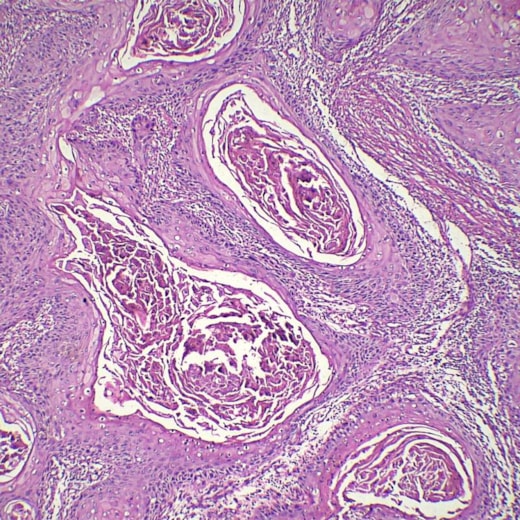 Lâminas Preparadas De Patologia 50 peças