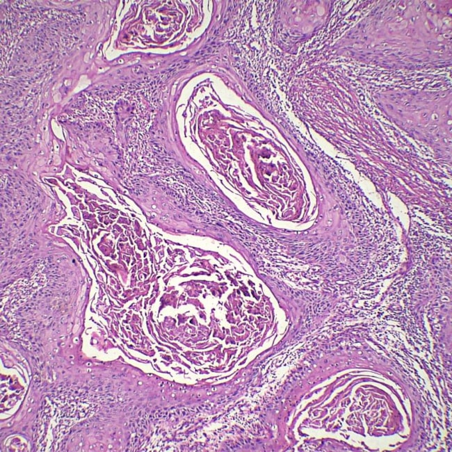 Lâminas Preparadas De Patologia 50 peças-135b7440-7888-46a9-a4d6-4f6f133d5a25