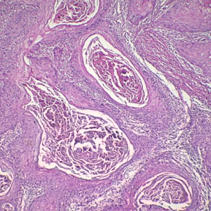 Lâminas Preparadas De Patologia 50 peças