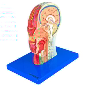 Metade da Cabeça com Musculatura e Corte Mediano