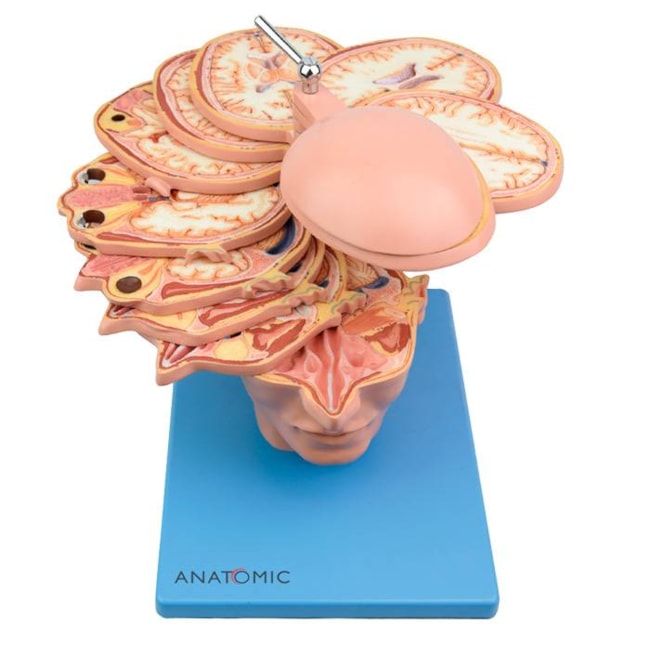 Modelo Anatômico da Cabeça em Cortes Axiais Luxo com 12 Discos-bbd68ed8-9c50-4c52-b859-73806c9022b2