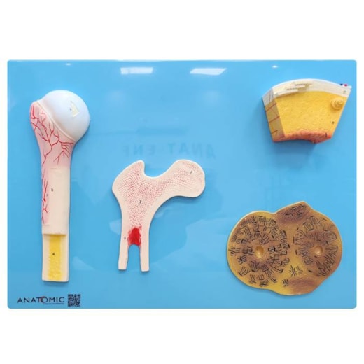 Modelo Anatômico de Estrutura Óssea Humana em Placa Didática