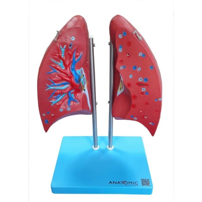 Modelo Anatômico do Pulmão Humano Dividido em 4 Partes-7ad9bb60-4d60-44c7-80c1-c881b7a1ff15
