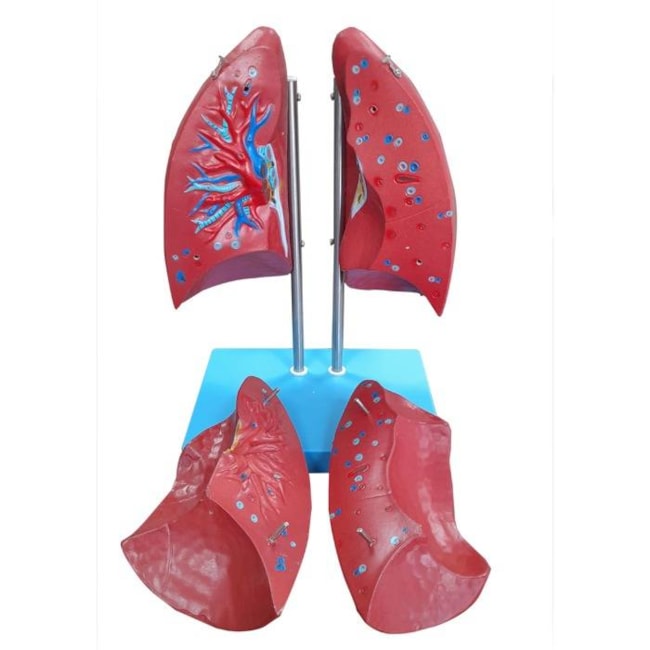 Modelo Anatômico do Pulmão Humano Dividido em 4 Partes-65c71f5e-6a4d-458e-b8c6-e28c5aa1fafe