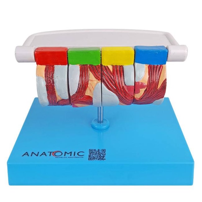 Modelo de Brônquio Saudável e Patológico-45fd1617-966d-4284-bb20-87dab852e015