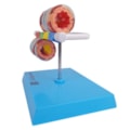 Modelo de Brônquio Saudável e Patológico-05a8364a-cdd0-46b5-961d-3cb3f7cc23f1