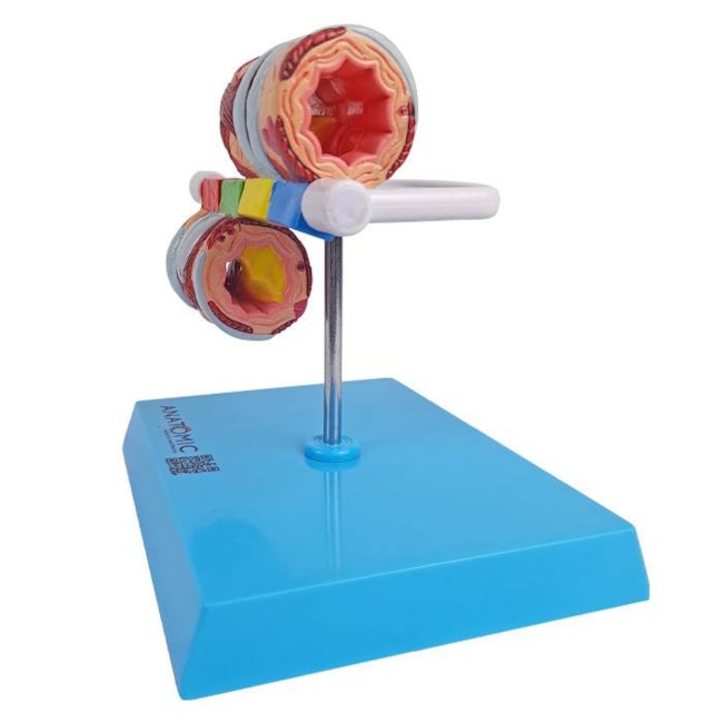 Modelo de Brônquio Saudável e Patológico-d2dacc12-13dc-4acf-a56b-a393e7d1bdd4