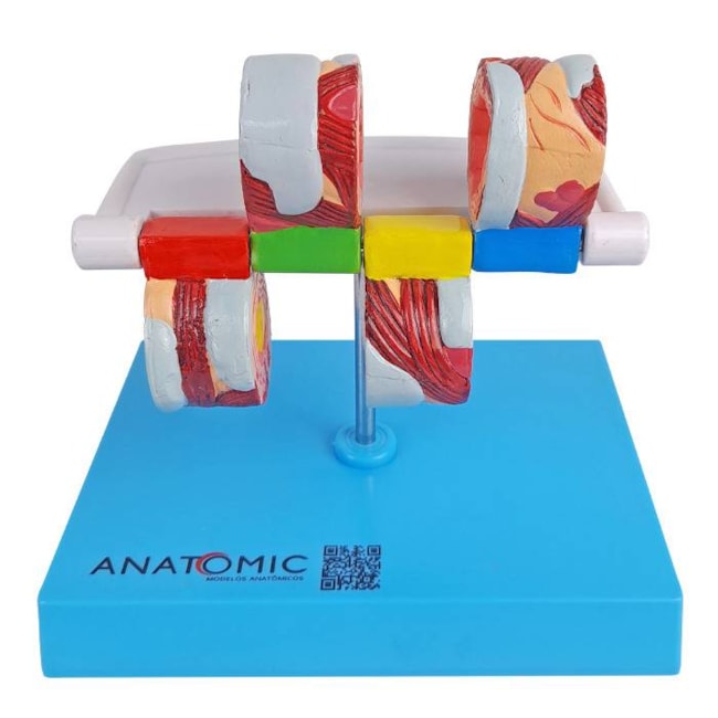 Modelo de Brônquio Saudável e Patológico-c4506e6b-12e5-410e-8848-9d210a2e5762
