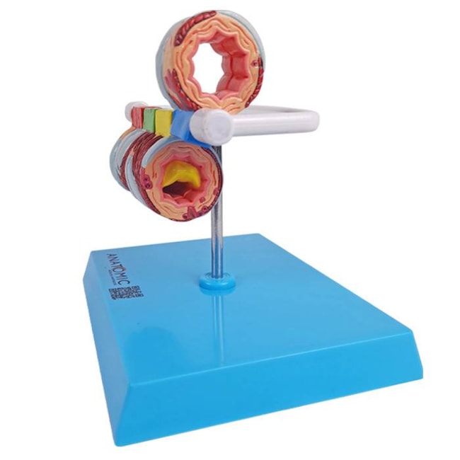 Modelo de Brônquio Saudável e Patológico-be8c97cd-406a-4d83-b6db-53c16515ea56