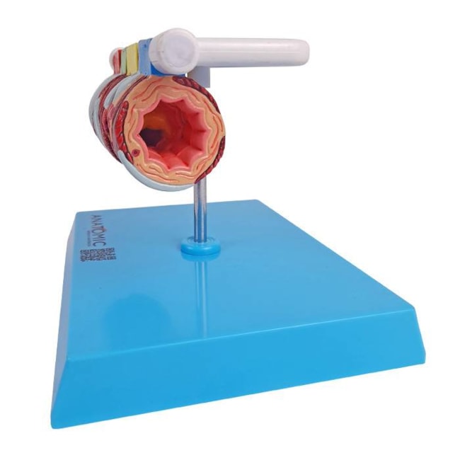 Modelo de Brônquio Saudável e Patológico-32a6ddbb-291a-42c4-a6f9-a8f719342381