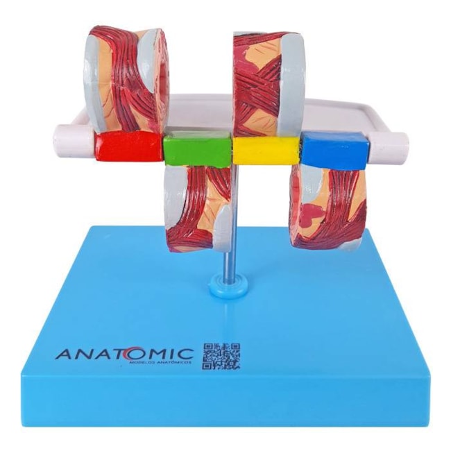 Modelo de Brônquio Saudável e Patológico-38d98a45-02a4-4329-9c1b-9e6907b413b8