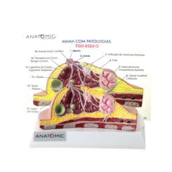 Modelo de Mama com Patologias