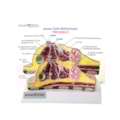 Modelo de Mama com Patologias-3512f7f7-418a-40c4-b5c9-9a23f158b515