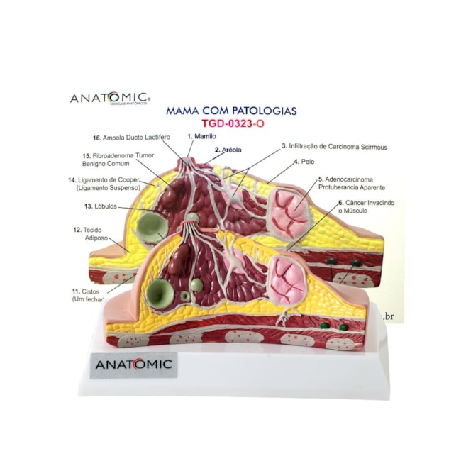 Modelo de Mama com Patologias-5b86e357-083f-4ff6-978f-0ed43223743c