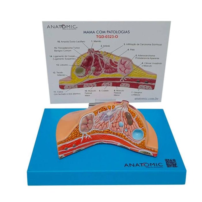Modelo de Mama com Patologias-b610d960-2beb-45ac-93f9-1a4fd7122846