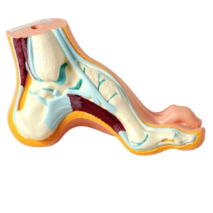Modelo de Pés Normal, Chato e Curvo