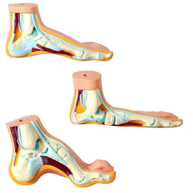 Modelo de Pés  Normal, Chato e Curvo-07cdf247-cfa5-493d-8698-a8dd632ab197