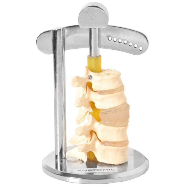 Modelo Para Demonstração da Movimentação Das Vértebras-d1ad1caf-26a1-48cc-9aa2-069c6d74b581