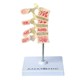 Osteoporose 4 Vértebras