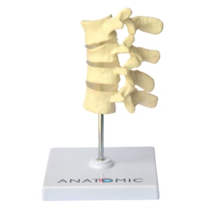 Osteoporose 4 Vértebras