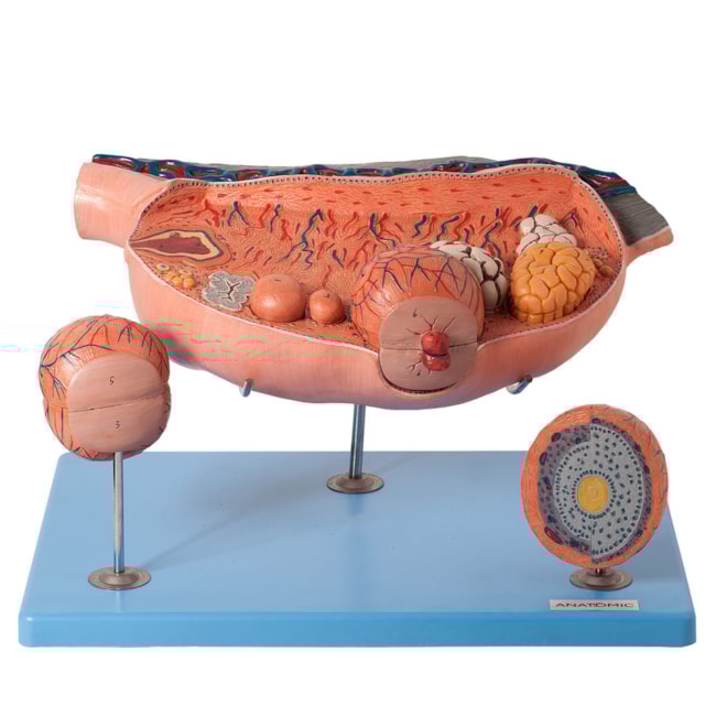 Ovário Ampliado 13 partes-7246d919-5bff-40fc-a1e7-e19e81bc8dcc