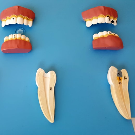 Patologia Dentária 12 Peças