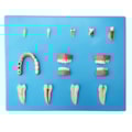 Patologia Dentária 12 Peças-be708eb6-f250-4465-99d2-fa738208b1fc
