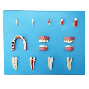 Patologia Dentária 12 Peças