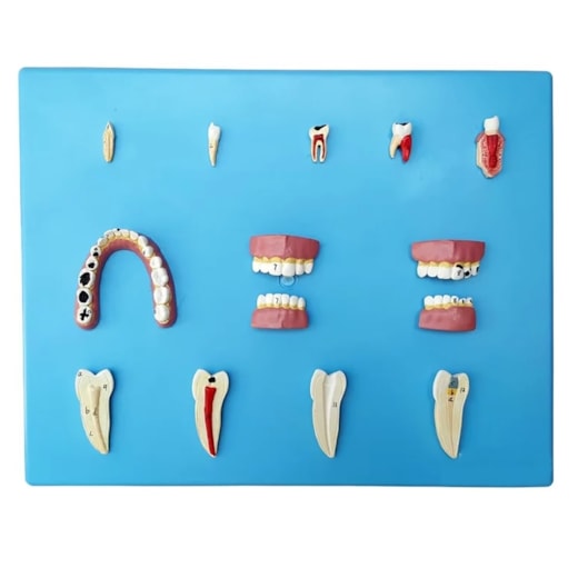 Patologia Dentária 12 Peças