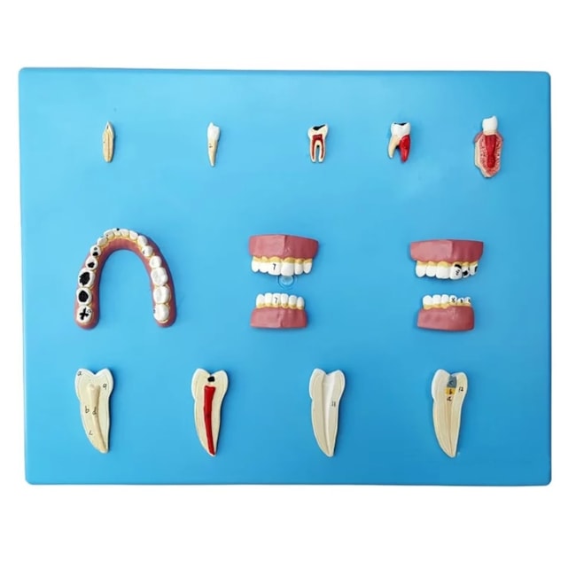 Patologia Dentária 12 Peças-0c2131b6-5200-4b5c-9cdd-f3212d6583fb
