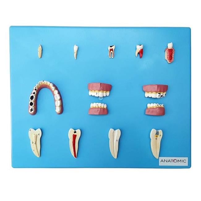 Patologia Dentária 12 Peças-8727ab82-89be-47f7-8605-70250738caf6