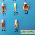 Patologia Dentária 25 Peças-733566c9-37cc-4bf4-a5dd-e30ec248789f