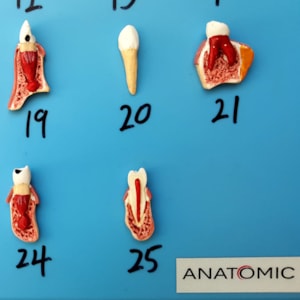 Patologia Dentária 25 Peças