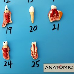 Patologia Dentária 25 Peças