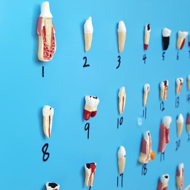 Patologia Dentária 25 Peças-a40ff04a-5ed5-4022-8a15-440478a2919c