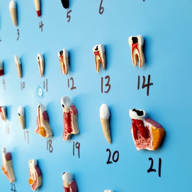 Patologia Dentária 25 Peças-2c017101-23fd-4b8f-a526-ec04f7fd5095