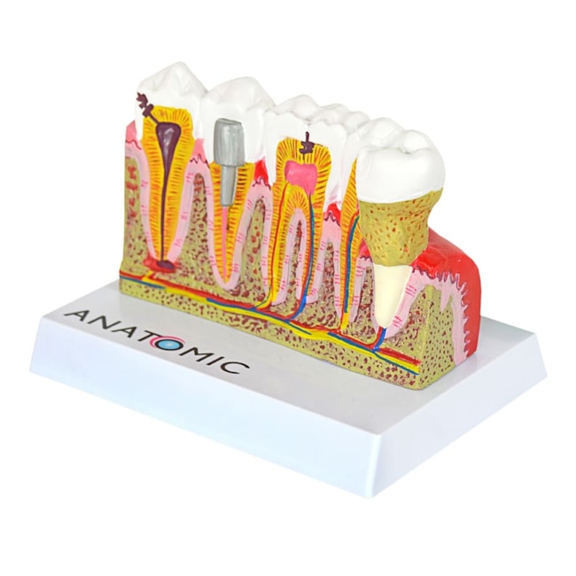 Patologia dos Dentes Com Prancha Explicativa-ba293c62-08f4-4547-8f14-ef38e0ec759b