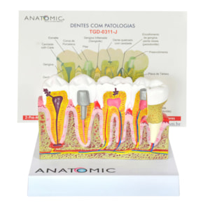 Patologia dos Dentes Com Prancha Explicativa