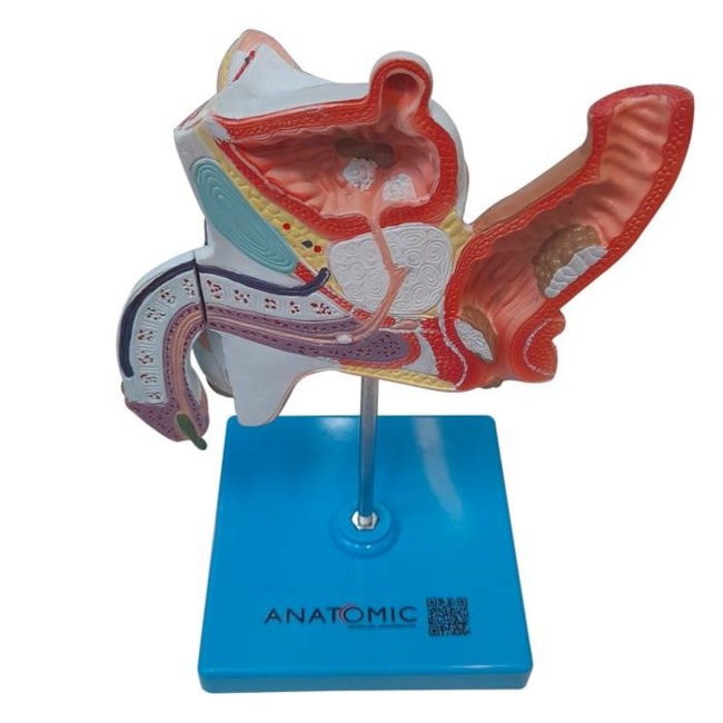 Patologias do Sistema Urogenital Masculino-eba24669-1393-4a39-a5d0-323c1edd2fd2