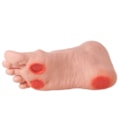 Pé Diabético-37d68547-bbf6-415a-9546-89d950645af4