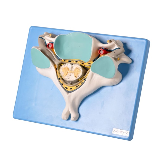 Quinta Vertebra Cervical Com Medula Espinhal e Nervos-b48b3701-af8f-4bb8-b959-45f2cbdcc40c