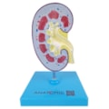 Rim com Patologias-52d0aeb7-3188-4d0c-af18-468b0c282770