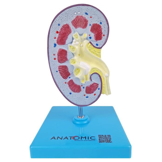 Rim com Patologias-734f4a90-4d35-4cbb-8b35-2b48670a1388