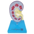Rim com Patologias-b2754cc9-3813-44bd-805c-63201de8d05d