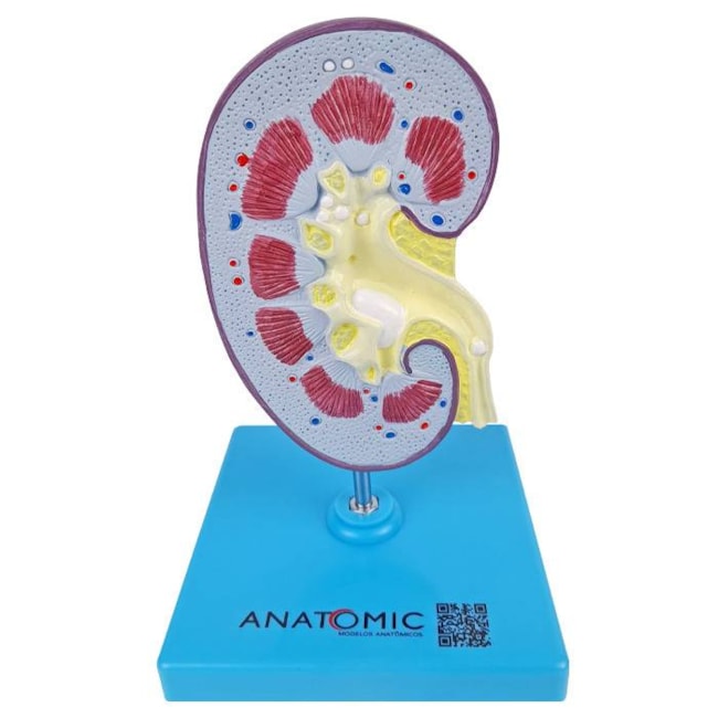Rim com Patologias-7d3c3035-320f-4f21-a3c2-a412b2191317