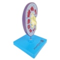Rim com Patologias-09cb32dc-1c2a-4941-8823-b5e1d7f01f62