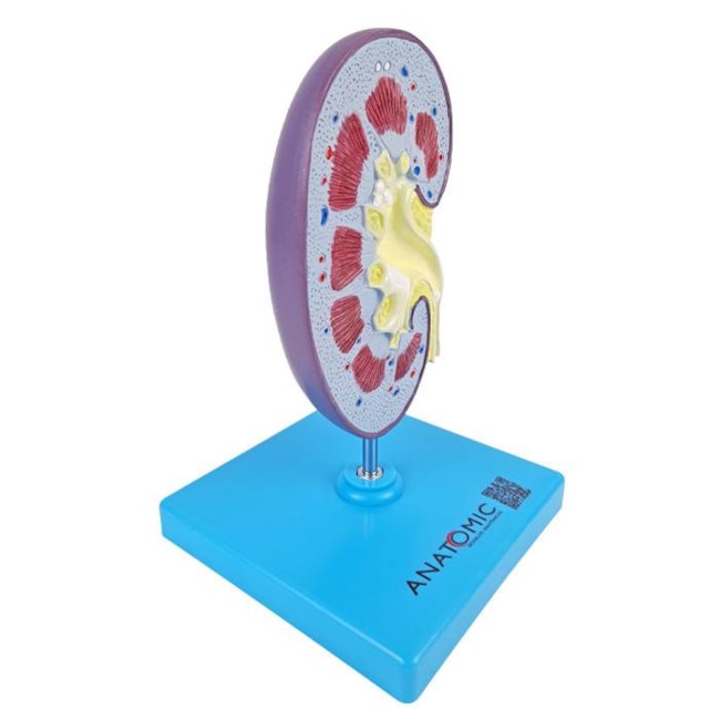Rim com Patologias-8eed853a-56af-474f-abe3-ff647f6f14ee