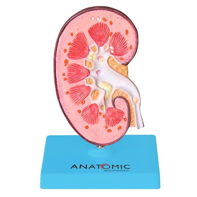 Rim com Patologias-48209736-dd0f-4e8d-a44d-2af1ed660f1e