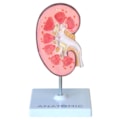 Rim com Patologias-f7e4e7ae-b554-42de-9991-1c01debb761d