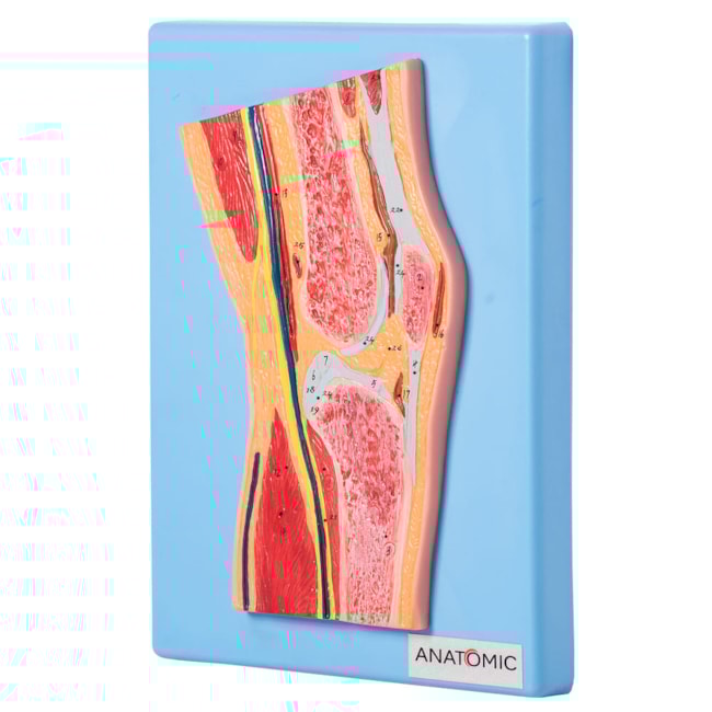Secção Mediana da Articulação do Joelho-6db30571-2c15-4b02-b231-196f77c58eb3